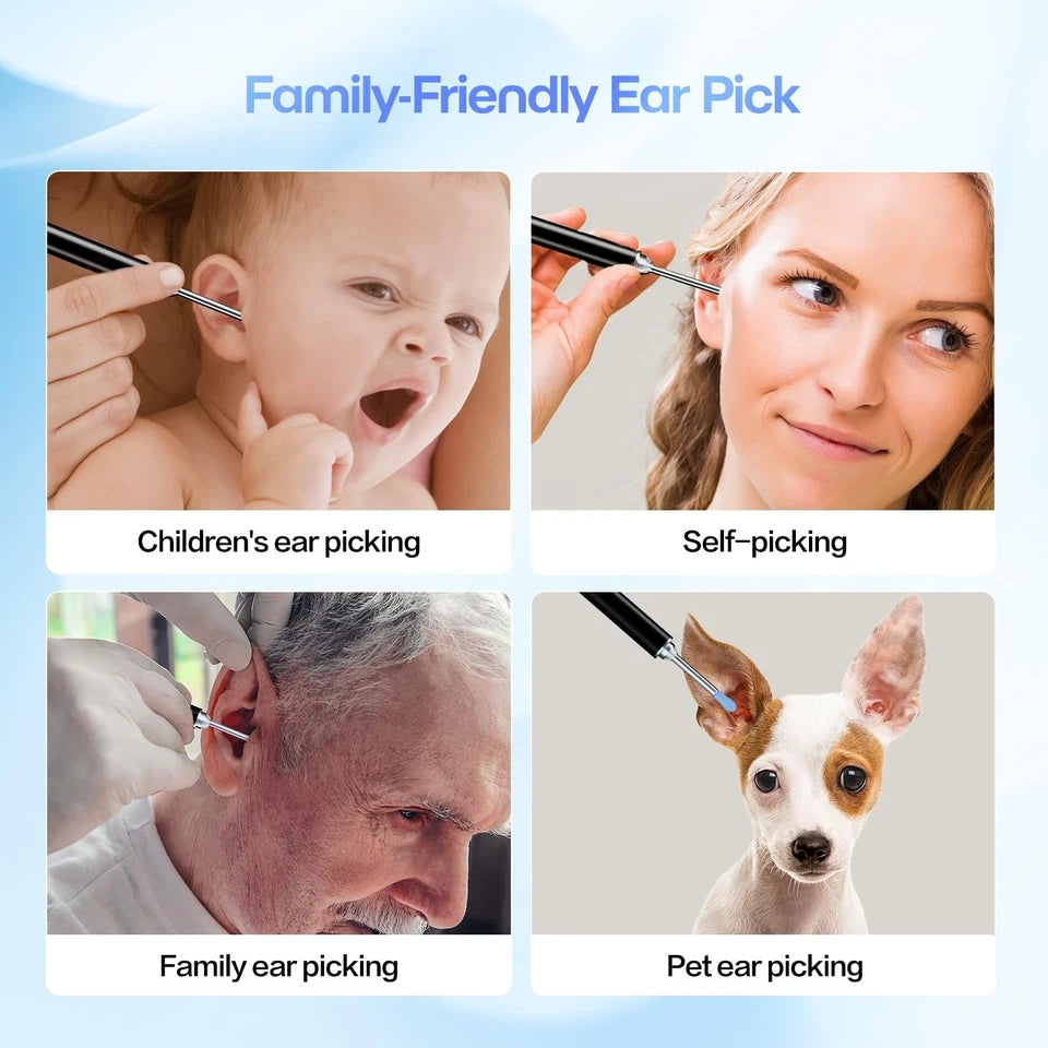 KoakiTM Ear Wax Wireless  Remover Set, 1296P Camera HD Ear Endoscope Spoon Pick Tools.