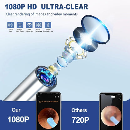 KoakiTM Ear Wax Wireless  Remover Set, 1296P Camera HD Ear Endoscope Spoon Pick Tools.